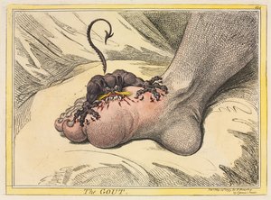 Die Gicht, 1799
