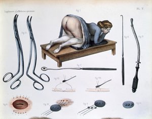 Eine Operation an einer vesikovaginalen Fistel, Tafel aus 