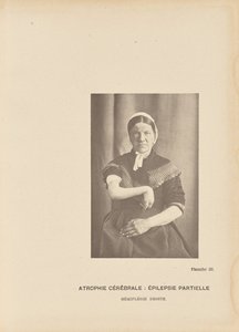 Zerebrale Atrophie: Partielle Epilepsie, rechte Hemiplegie