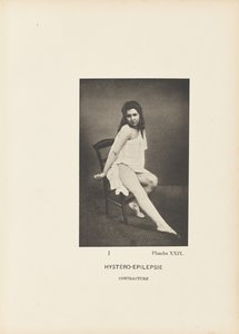 Hystero-Epilepsie Kontraktur von Paul Marie Léon Regnard