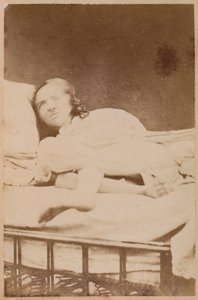 Hysterische Epilepsie, Verrenkungen, Tafel XXXVIII aus 