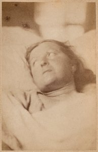 Hysterische Epilepsie, Kreuzigung, Kopfhaltung, Tafel VII aus 