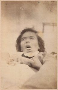 Hysterische Epilepsie, Halluzinationen, Angst, Tafel XXIX aus 