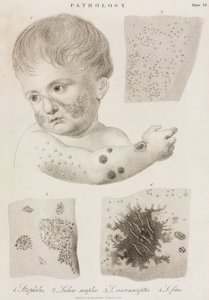 Dermatologie Arten von Hautkrankheiten