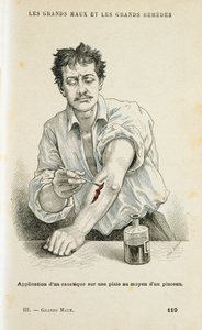 Eine Wunde mit einer antiseptischen Lösung behandeln, um 1890 von Unbekannt