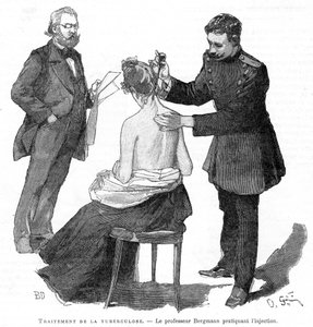 Professor Bergmann injiziert einem Tuberkulosepatienten, 1891 von Unbekannt