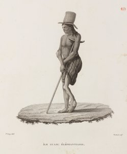 Krankheiten, Tropische Krankheiten Mann mit Elephantiasis, Guam