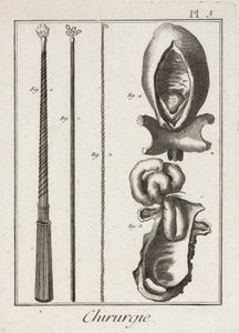 Ausrüstung, frühmoderne chirurgische Instrumente und Diagramme von Körperteilen von Unbekannt
