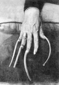 Monströse Besonderheit: Eine Hand mit sehr langen Nägeln. China um 1910. Historisches Foto, lange Fingernägel, China, ca. 1910.