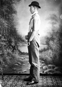 Prothesen Mann mit künstlichem Arm