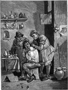 Ein Scharlatan-Chirurg im 18. Jahrhundert untersucht eine Schulterverletzung. (Nach einer Gravur der Zeit). Gravur in „La Nature: revue des sciences et de leurs applications aux arts et a l