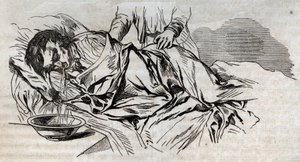 Unfallmedizin - über die wirksamste Hilfe für Ertrunkene - die Walnusswindeln auf der Seite und das Erbrechen des getrunkenen Wassers - Gravur in „La Santé Universelle - Guide Médical des Familles“ 1852