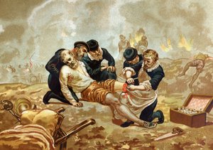 Ambroise Pare Arzt und französischer Chirurg (ca. 1509-1590) praktiziert die Ligatur von Arterien nach der Amputation. aus „Hombres y Mujeres celebres“. Barcelona 1877.
