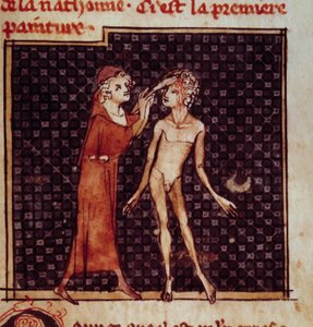 Anatomische Figur: Der Chirurg schneidet die Stirn eines Patienten auf. Miniatur aus dem Manuskript „Chirurgie“ von Henri de Mondeville