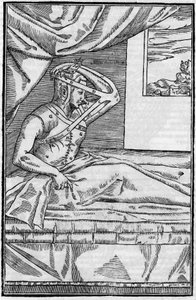 Nasenchirurgie: Rekonstruktive Chirurgie an der Nase in „De curtorum chirurgia per insitionem“. Venedig von Unknown artist
