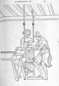 Reduktion von Frakturen. Illustrierte Tafel aus „De dissectione partium corporis humani libri tres...“ von Carlo Stefano Riverio, Paris 1545