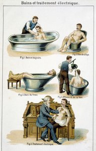 Bäder und elektrische Behandlung: 1) Badewanne, 2) Sitzbad, 3) Rumpfbad, 4) Rückenbad, 5) Elektrische Behandlung - in „Bilz, Naturheilkunde“, Ende des 19. Jahrhunderts