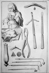Trepanation des Schädels, verschiedene Instrumente (Gravur)