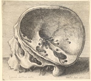Profil eines geschnittenen Schädels nach links mit entferntem linken Schädelteil, 1651 von Wenceslaus Hollar