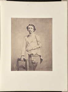 Erfolgreiche Exzision des Kopfes des linken Humerus, gefolgt von Nekrose und sekundärer Exzision des restlichen Humerus und der oberen Extremitäten des Radius und der Ulna von William H. Bell