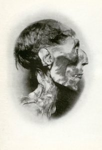 Kopf der Mumie von Ramses II., altägyptischer Pharao der 19. Dynastie, um 1212 v. Chr., 1926 von Winifred Mabel Brunton