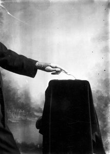 Prothesen - Mann mit einer Prothesenhand