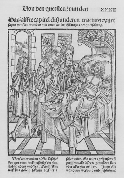 Das Buch der Chirurgie von Hieronymus Brunschwig von (after) German School