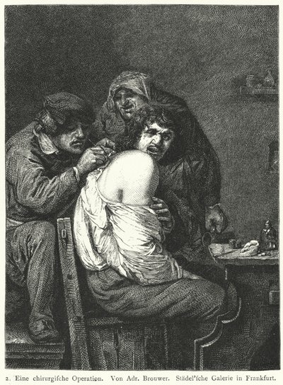 Die Rückenoperation von Adriaen (after) Brouwer