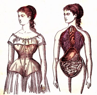 Korsettkompression - Normales Leben und Gesundheit von J. Rengade. Zeichnung A. Demarle 1881 von Alphonse Demarle