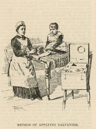 Das West End Hospital für Lähmung und Epilepsie, Welbeck Street, London: Methode zur Anwendung von Galvanismus von Amedee Forestier