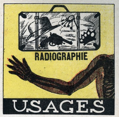 Röntgenstrahlen: Verwendung von Röntgenstrahlen, um durch Objekte und Körper zu sehen. Anonyme Illustration von 1925. Private Sammlung. von Anonymous Anonymous