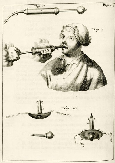 Verwendung einer Spritze zur Verabreichung eines Abführmittels, aus Exercitationes Practicae circa Medendi Methodum von Frederik Dekkers, 1694 von Dutch School