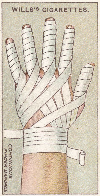 Durchgehender Fingerverband, Nr. 48 aus der Erste-Hilfe-Serie von Willss Zigarettenkarten, 1913 von English School
