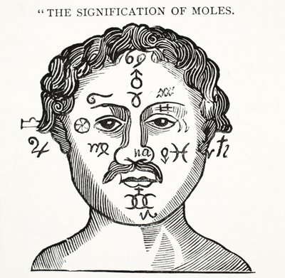 Die Bedeutung von Muttermalen, Illustration aus Chap-books of the Eighteenth Century von John Ashton, veröffentlicht 1882 von English School