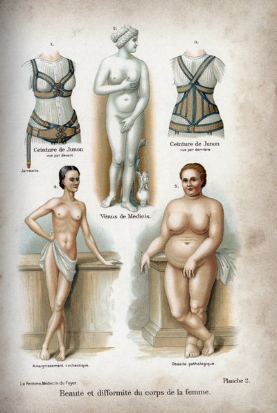 Schönheit und Deformität des Frauenkörpers: eine zu dünne und eine fettleibige Frau unter der Venus von Medici, als „ideale Frau“ betrachtet von French School