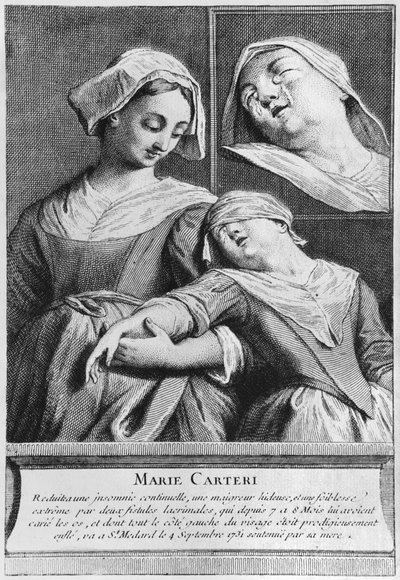 Wundersame Heilung einer blinden Frau, Marie Carteri, am Grab von Diakon François de Paris auf dem Pfarrfriedhof Saint-Médard in Paris von French School