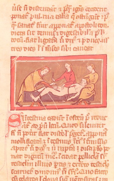 Ms H 89 fol.23 Chirurgie, aus einer Ausgabe des Buches der Chirurgie von Rogier de Salerne von French School
