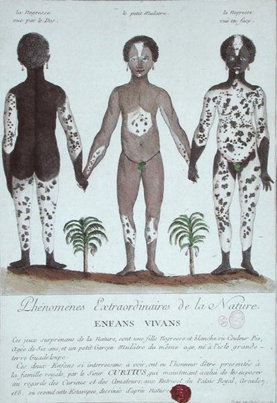 Das Phänomen der Leukodermie von French School