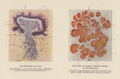 Actinomyces bovis von German School