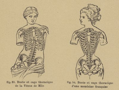 Vergleich der Brust- und Rippenform der Venus von Milo mit der einer französischen Gesellschaftsdame des späten 19. Jahrhunderts von German School