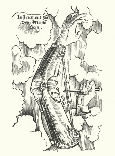 Instrument zur Behandlung eines verletzten Arms (Gravur) von German School