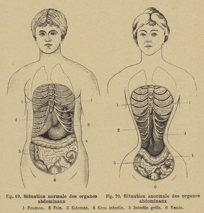 Normale Lage der inneren Organe des Bauches bei Männern und Frauen von German School