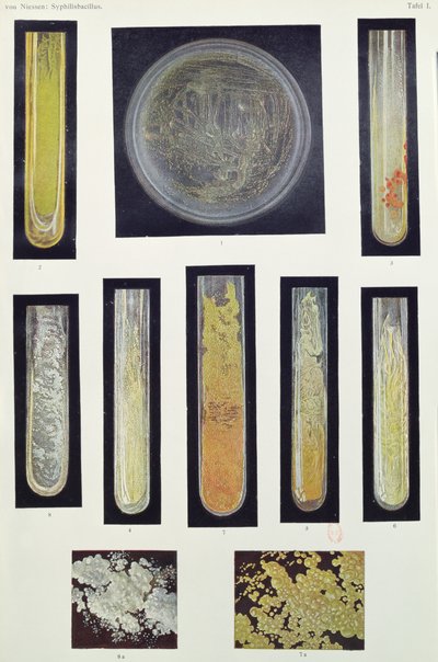 Syphilus Bacillus, aus einem Buch von Max von Niessen, Leipzig, 1908 von German School