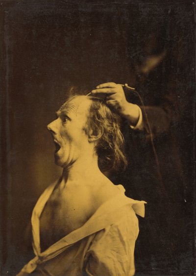 Erstaunen, Verblüffung, Staunen von Guillaume Benjamin Armand Duchenne de Boulogne