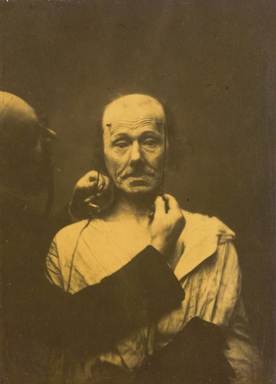 Aufmerksamkeit, 1854-1856, gedruckt 1862 von Guillaume-Benjamin-Armand Duchenne de Boulogne