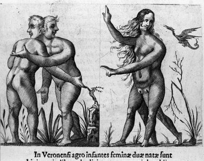 Verschiedene Arten menschlicher Monster: ein Mann mit doppelten Körpern und Köpfen und eine Frau mit vier Beinen und zwei Geschlechtern. Stich aus „De monstrorum natura, causis et differentiis“ von Fortunio Liceti (1577-1656), italienischer Wissenschaftler von Italian School