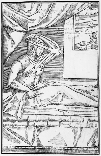 Rekonstruktive Nasenchirurgie, Illustration aus 