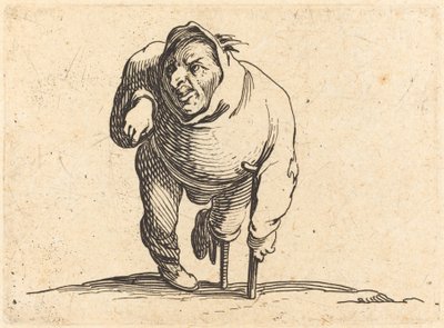 Krüppel mit Krücke und Holzbein von Jacques Callot