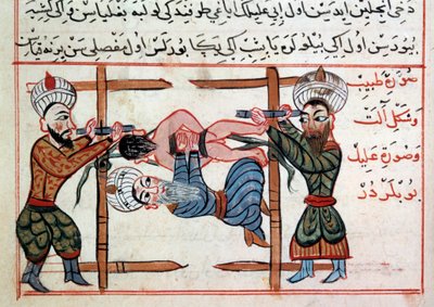 Reduktion einer Fraktur von Ottoman School