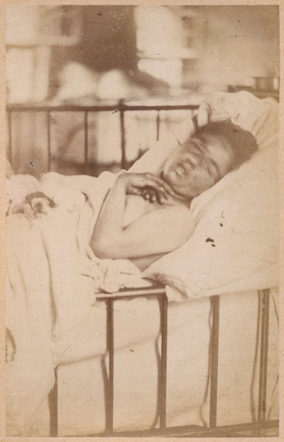 Hysterische Epilepsie, permanente Kontraktion, Tafel XXVIII aus 
